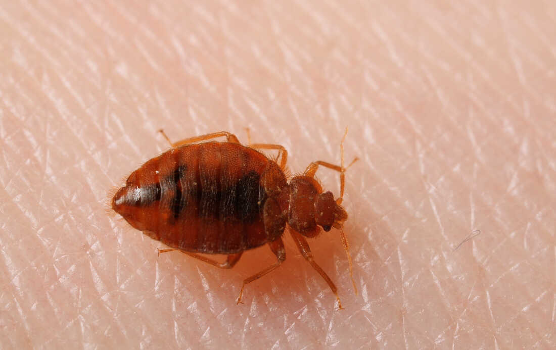 9 Symptoms and Signs of Bed Bugs